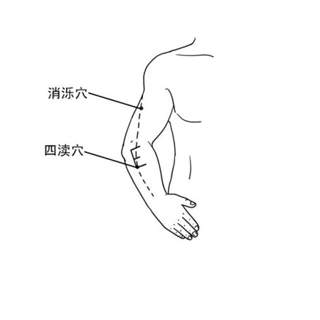 消濼穴→治頭痛、頸項(xiàng)強(qiáng)痛