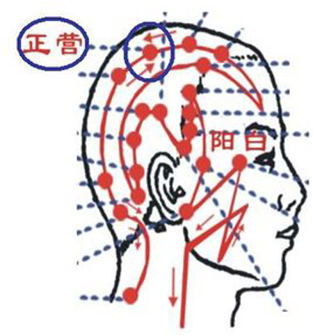 正營穴→治頭痛、頭暈