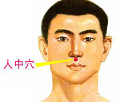 水溝穴→治昏迷、暈厥
