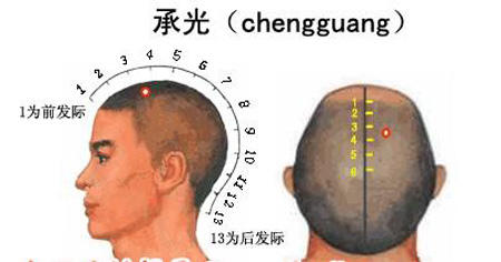 承光穴→治頭痛、鼻炎
