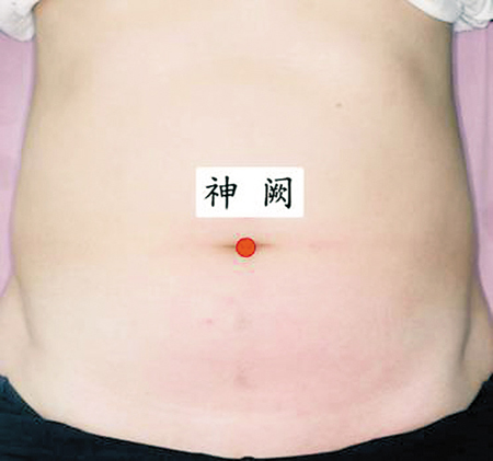 神闕穴→治腸炎、痢疾