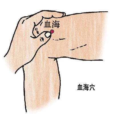 血海穴→治濕疹、丹毒