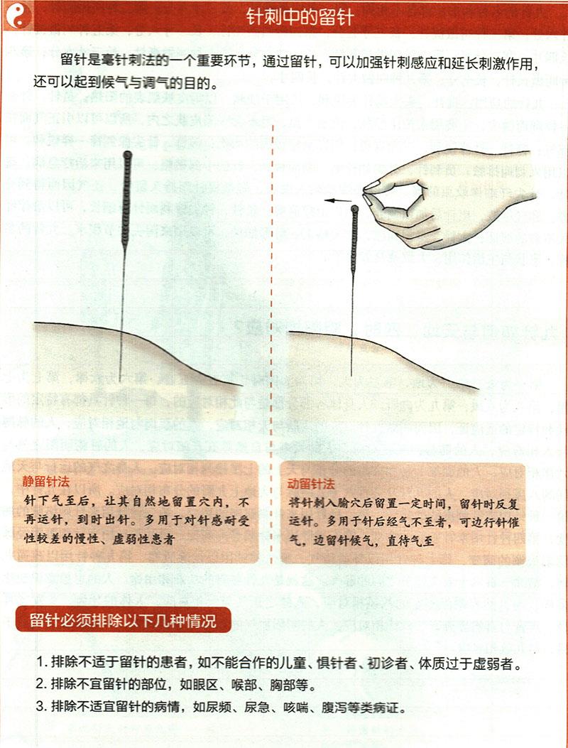 針刺穴位時(shí)有哪些需要注意的？