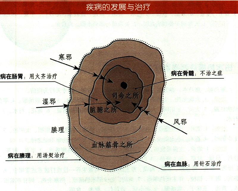 諸氣應(yīng)怎樣治療？