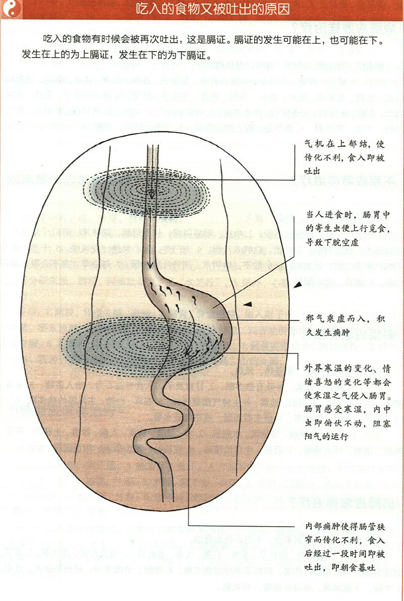 嘔吐應(yīng)怎樣治療？