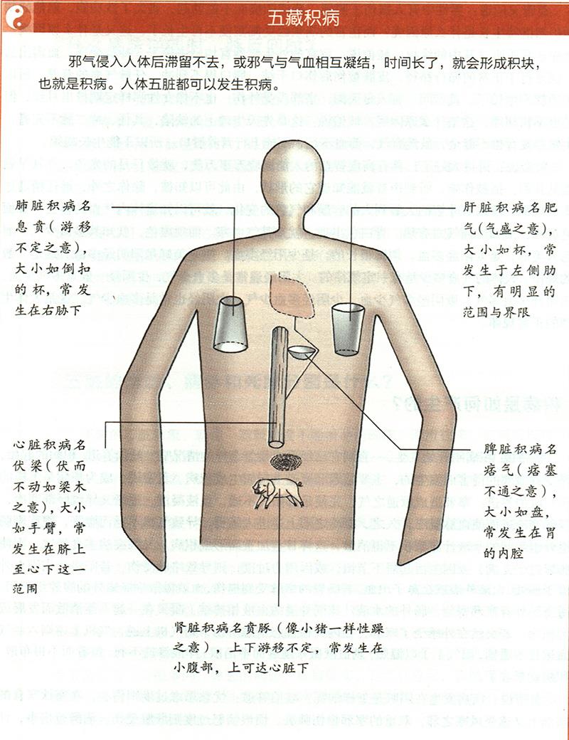 積病是如何產(chǎn)生的？