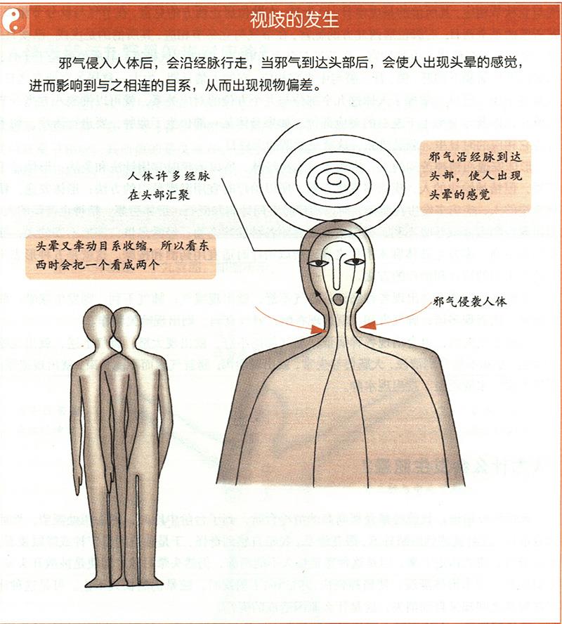 人為什么會發(fā)生眩暈？